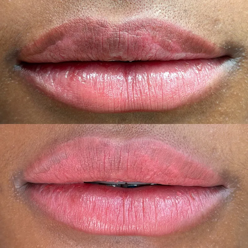Resultado de micropigmentación de labios de Carolina Zarate