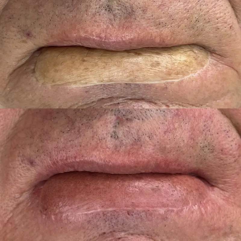 Resultado de micropigmentación de labios de Carolina Zarate