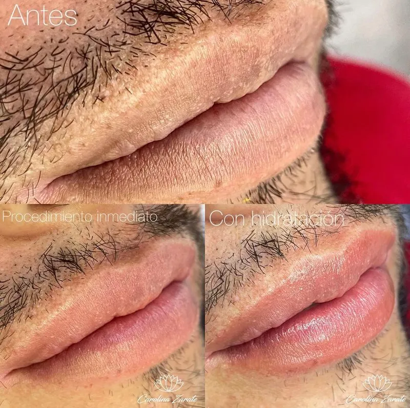 Resultado de micropigmentación de labios de Carolina Zarate