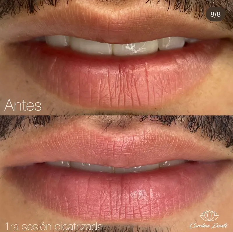 Resultado de micropigmentación de labios de Carolina Zarate