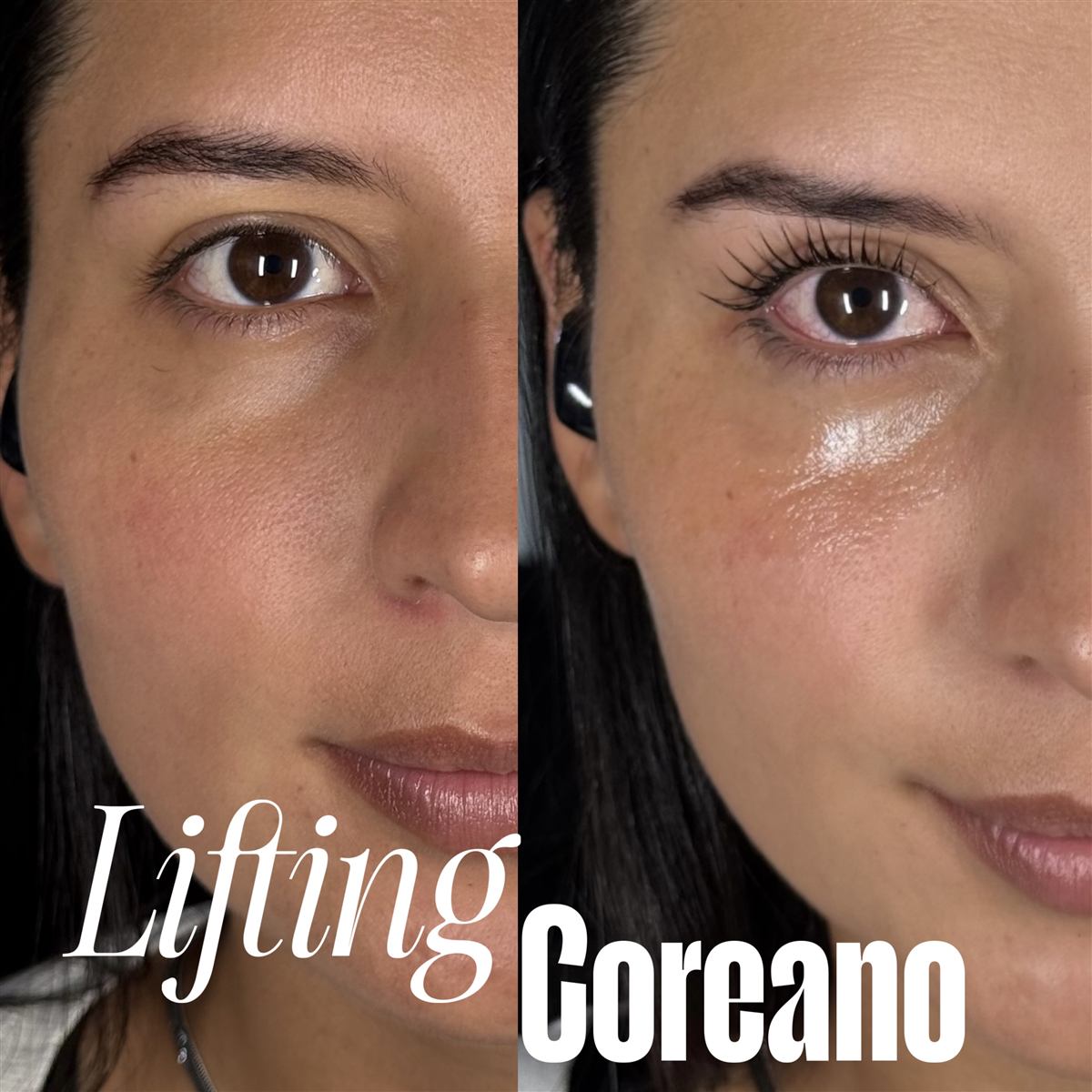 Lifting de pestañas coreano Banhada en Medellín — resultado 1