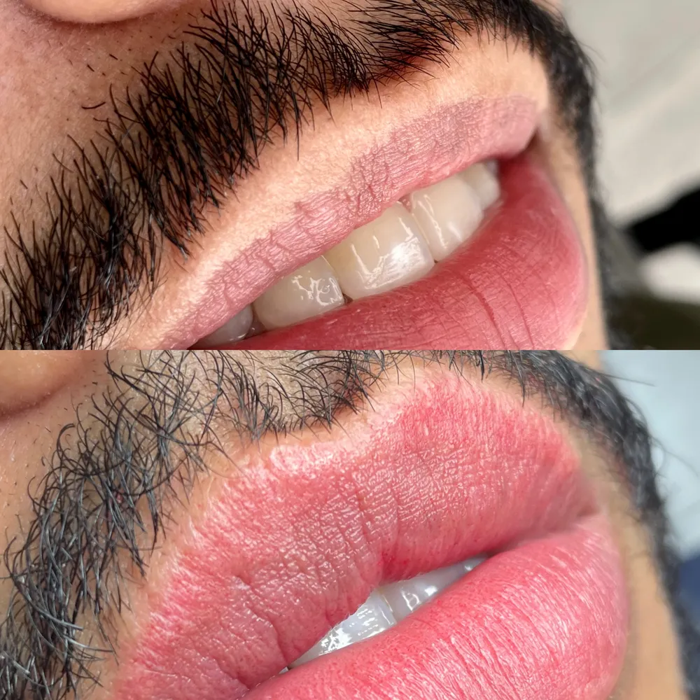 Resultado de micropigmentación de labios de Carolina Zarate