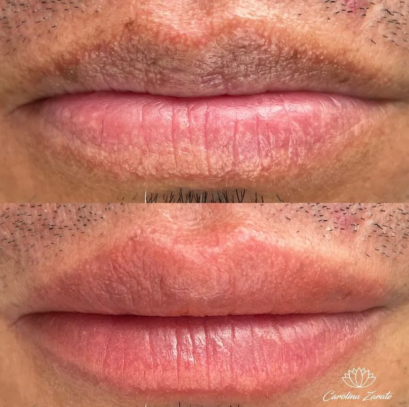 Resultado de micropigmentación de labios de Carolina Zarate